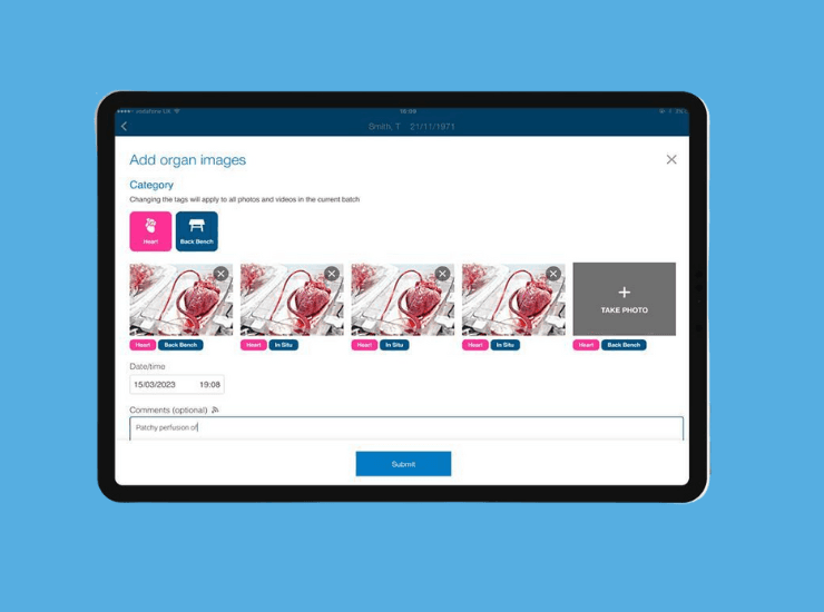 NHS TransplantPath iPad image